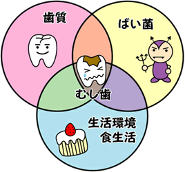 むし歯の原因